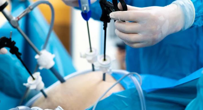  غدا الجمعة: الإعلان عن تقنية جراحية مبتكرة في علاج مرض السمنة
