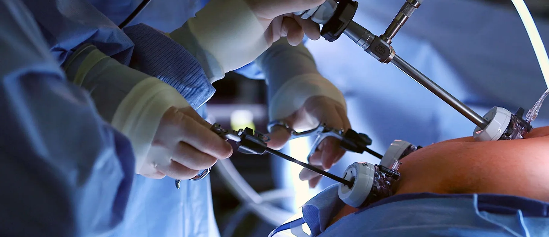  Sfax : Une Révolution chirurgicale contre l’obésité dévoilée au Congrès National de Chirurgie Bariatrique