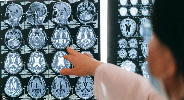  الخرف والزهايمر: علماء يؤكدون أن جذور المرض تعود إلى الطفولة والوقاية ممكنة